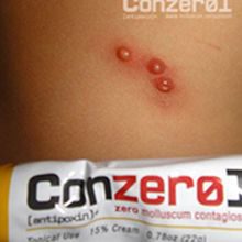 conzerol Before