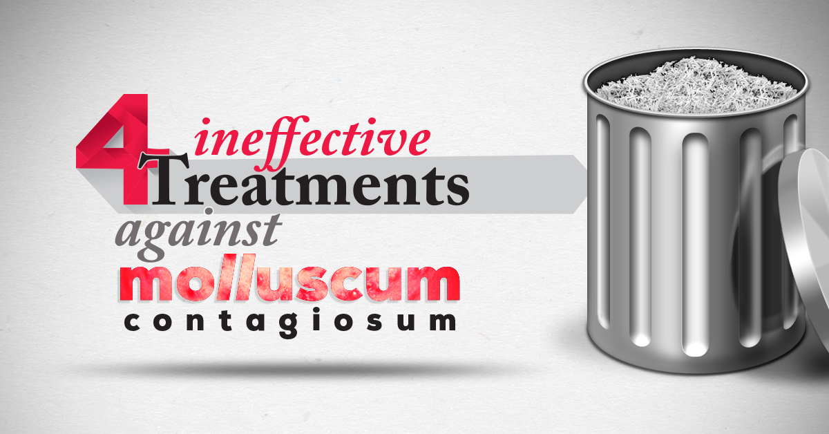 4 Treatments That Are Ineffective Against Molluscum Contagiosum - Conzerol