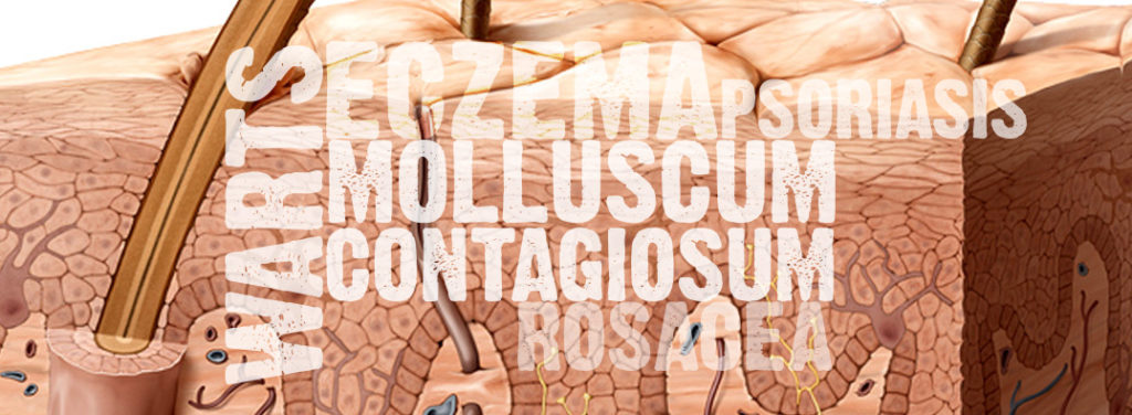 5 Skin Diseases Commonly Confused with Molluscum Contagiosum - Conzerol