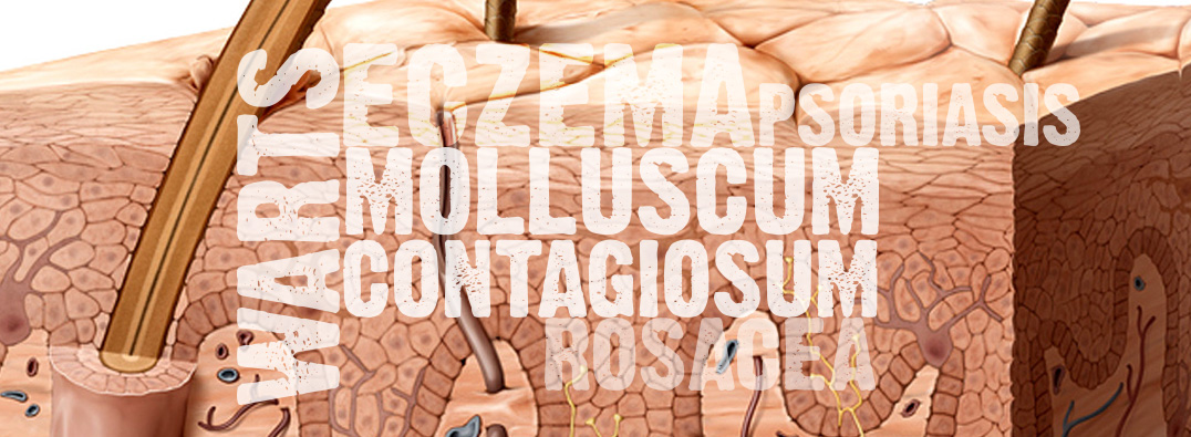 5 Skin Diseases Commonly Confused with Molluscum Contagiosum - Conzerol