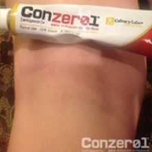 conzerol 17 days after Conzerol